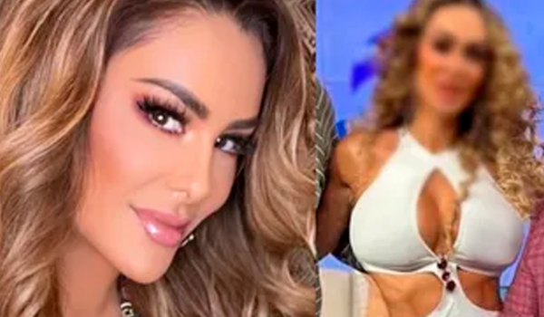 Impacta rostro de Ninel Conde tras retiro de biopolímeros; Aquí las imágenes